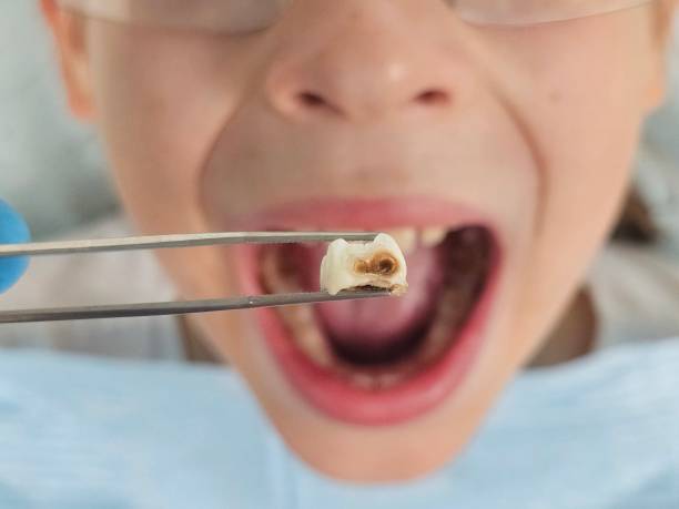 Best Emergency Treatment for Toothache in South Coatesville, PA